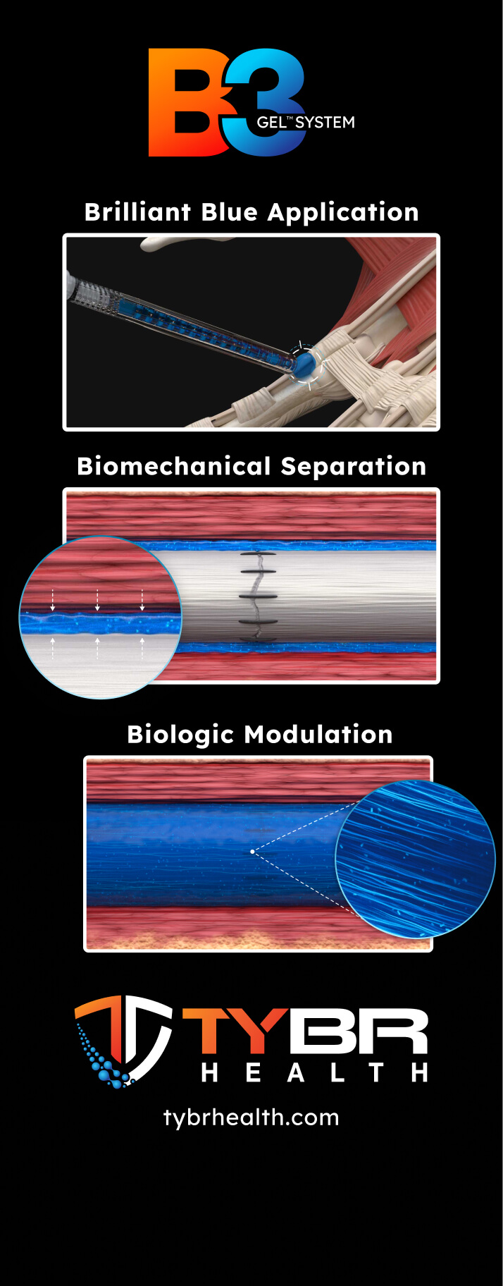 B3 Gel System clinical performance study creative