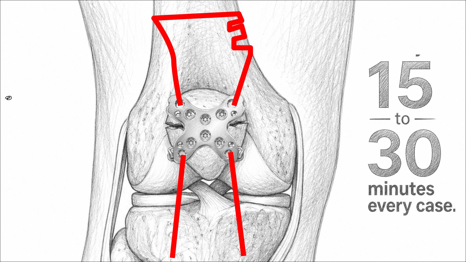 Summit Patella storyboard frame 14