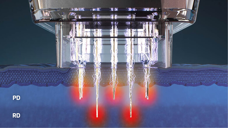 Medical device launch visual asset